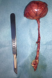 Néphromégalie gauche, notez la modification de l’uretère gauche. (photo Dr Millet, clinique vétérinaire des Hutins)
