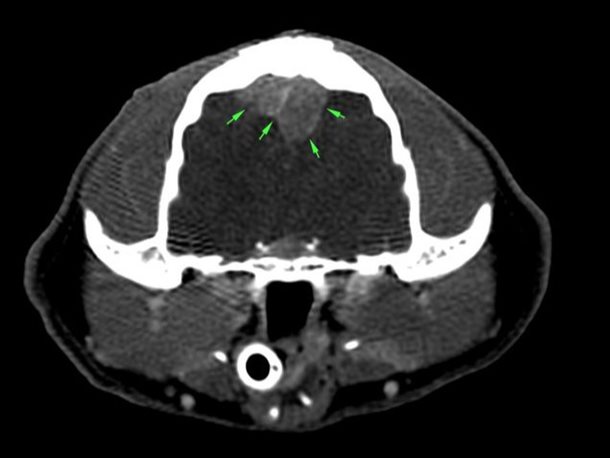 Images compatibles avec un processus tumoral de type méningiome (lymphome, sarcome histiocytaire non exclu). Un processus granulomateux semble beaucoup moins probable. 1