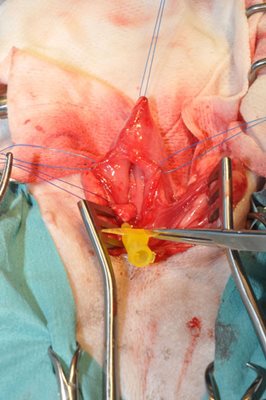 Tunnélisation de l’uretère en position physiologique au niveau du trigone vésical